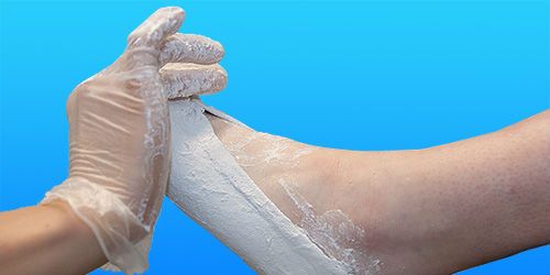 Orthotics Service Image