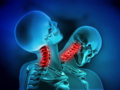 Whiplash Injuries Image