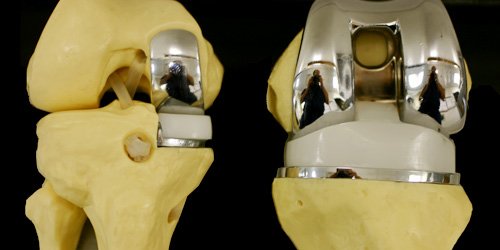 Post Surgical Rehab Image